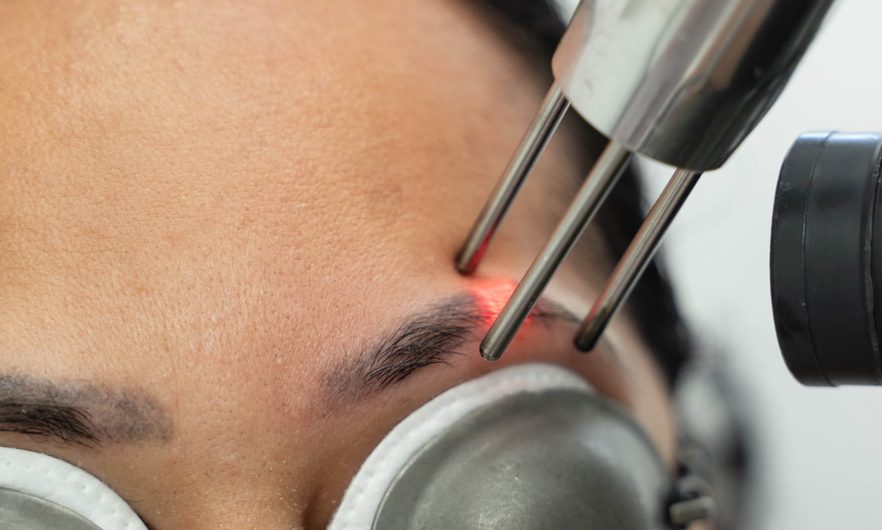 Why Laser Tattoo Removal and Cover-Ups Go Hand in Hand for Your Next Tattoo